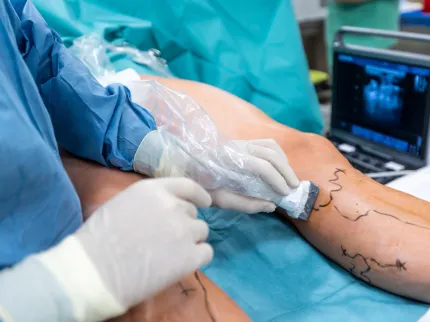 Jambe d'un patient au bloc opératoire avec un chirurgien.