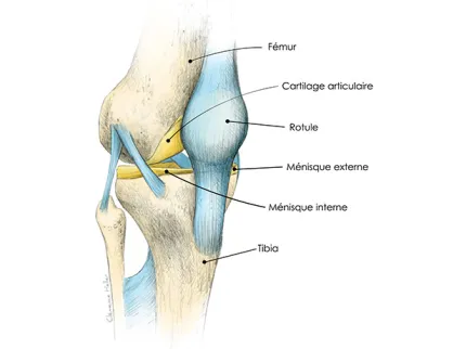 Illustration traitement prothèse de genou articulation