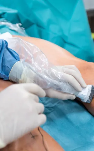 Jambe d'un patient au bloc opératoire avec un chirurgien.