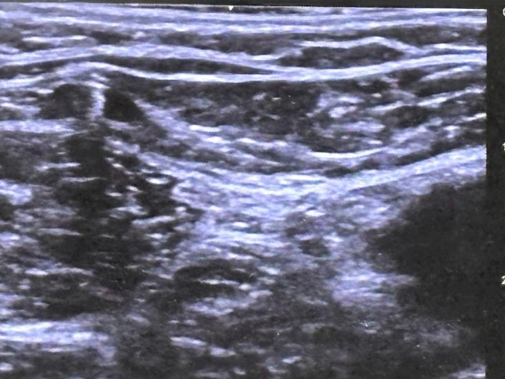 controle-echographique-permanent