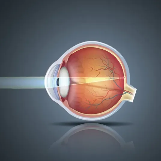 Image représentant l'injection Intra-Vitréenne (IVT) pour le Groupe Vivalto Santé