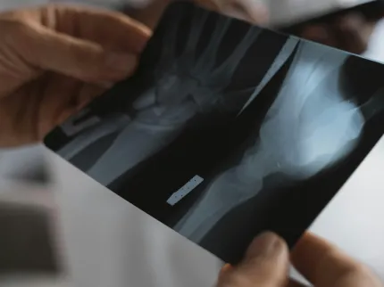 ZOom sur les mains d'une médecin regardant la radiothérapie d'un patient