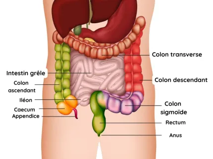 cancer colorectal : schéma organes avec textes