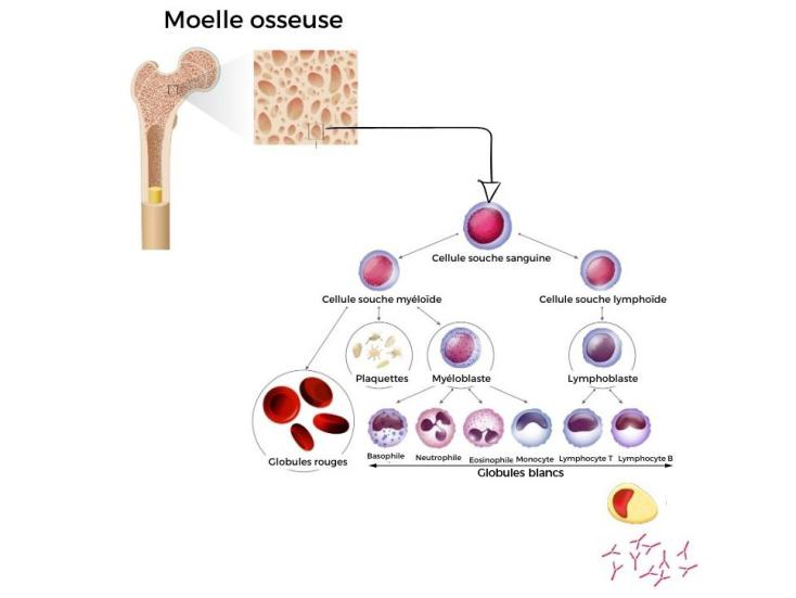 Cancer du sang : schéma décomposition moelle osseuse