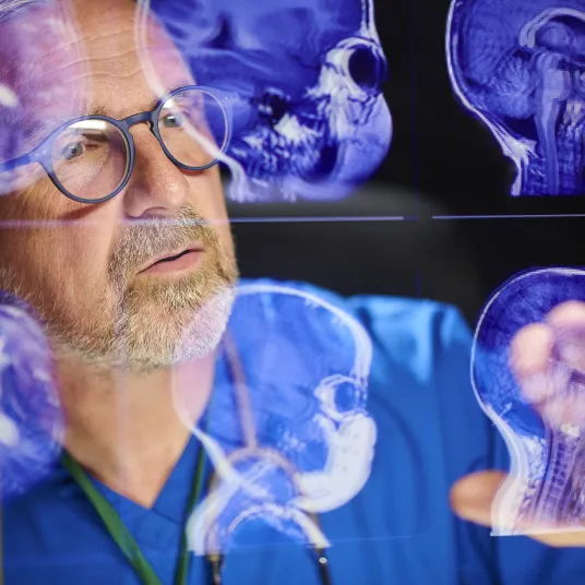 Médecin regardant des radiologies d'un cerveau, groupe Vivalto Santé