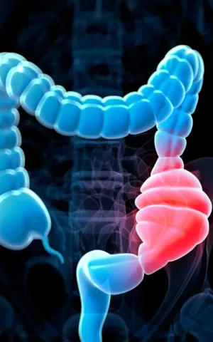 La gastro-entérologie et hépatologie à la Clinique de la Région Mantaise