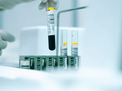 Photo de tubes de prise de sang