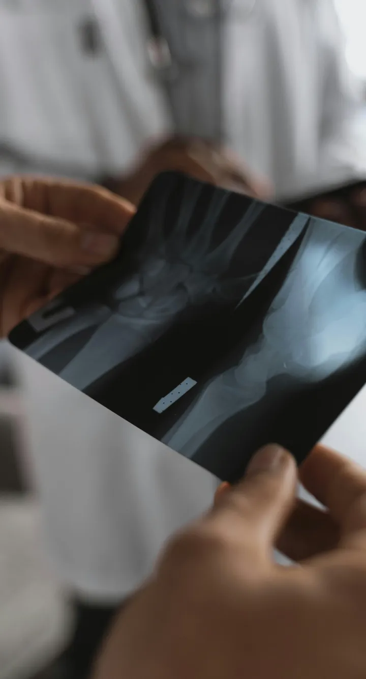 ZOom sur les mains d'une médecin regardant la radiothérapie d'un patient