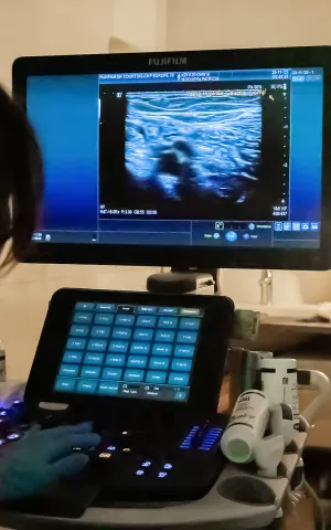 Médecin vasculaire (Angiologue) en train de faire un écho-doppler