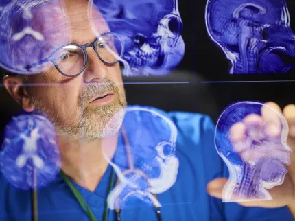 Médecin regardant une radiologie d'un cerveau- Groupe Vivalto Santé