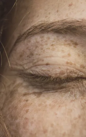 Zoom sur l'oeil fermé d'une femme. Groupe Vivalto Santé