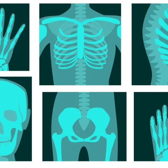 Image du squelette humain a travers des radiologies, représentant la spécialité chirurgicale d'orthopédie traumatologique.