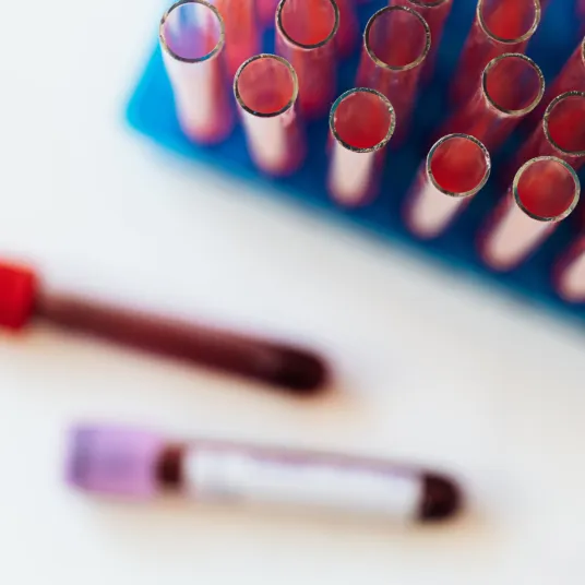 Hématologie - ILLUSTRATION