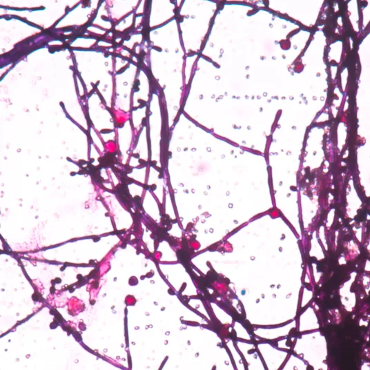 Angiologie - ILLUSTRATION