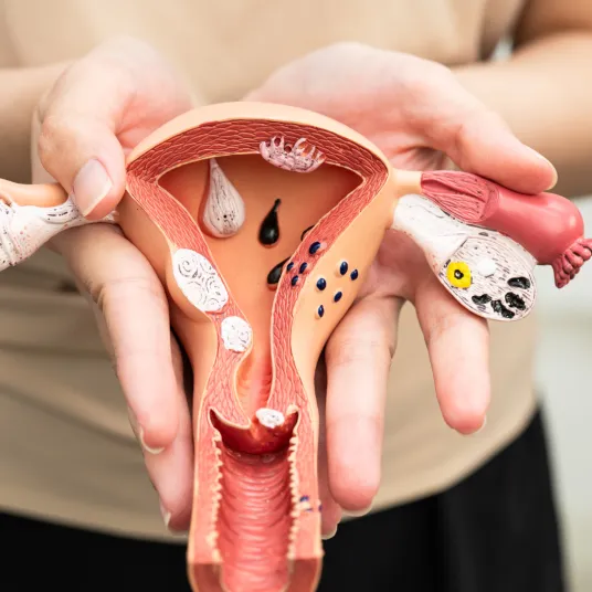 Chirurgie Gynécologique - ILLUSTRATION