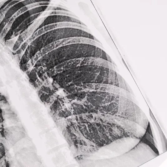 Pneumologie - ILLUSTRATION