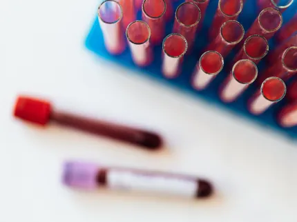 Hématologie - ILLUSTRATION