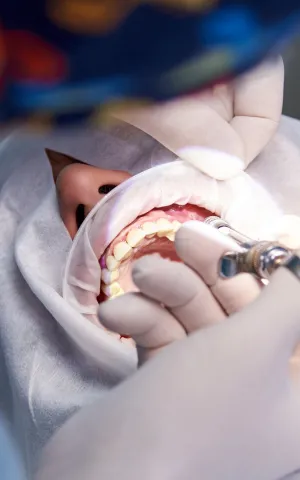 Chirurgie Dentaire - Illustration - 1