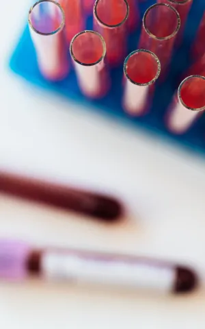 Hématologie - ILLUSTRATION