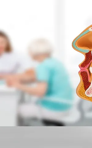 ORL & Chirurgie cervico-facial & Chirurgie face et cou - ILLUSTRATION