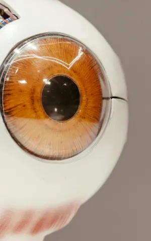 Chirurgie Ophtalmologique - ILLUSTRATION