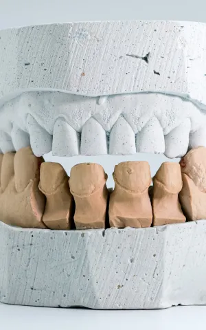 Stomatologie, chirurgie maxillo-faciale et Chirurgie orale - ILLUSTRATION