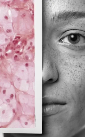 Dermato-Venerologie - ILLUSTRATION