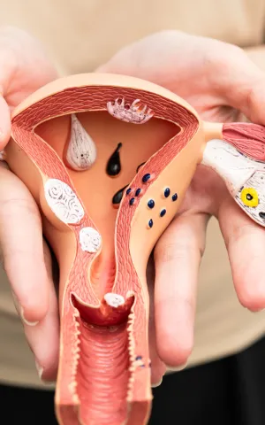 Chirurgie Gynécologique - ILLUSTRATION