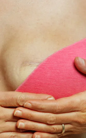 Sénologie et reconstruction mammaire