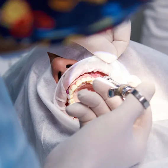 Chirurgie Dentaire - Illustration - 1