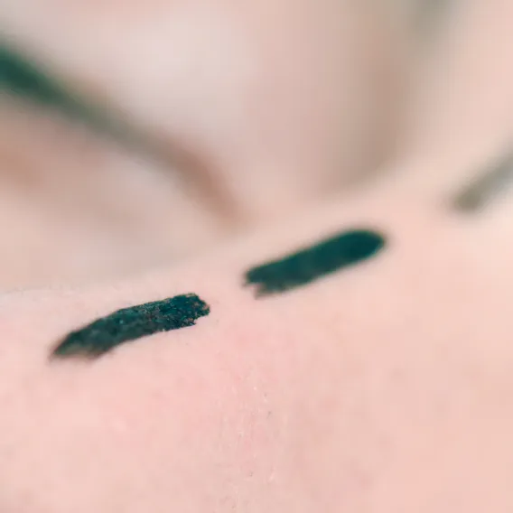 Chirurgie plastique, reconstructrice et esthétique - Illustration - 1