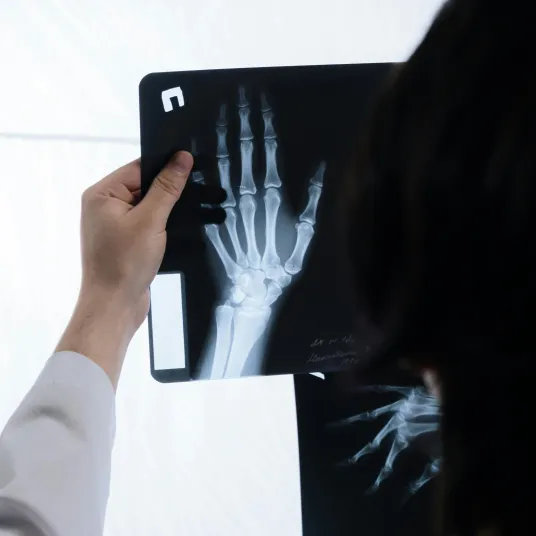 Médecin regardant la radiologie d'une main. Groupe Vivalto Santé