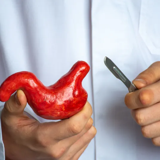 Chirurgie Bariatrique - ILLUSTRATION V1