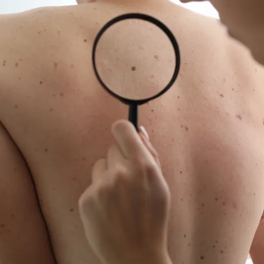 Dermatologie - ILLUSTRATION