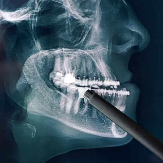 Maxillo faciale - ILLUSTRATION