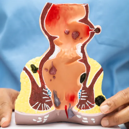 Proctologie - ILLUSTRATION