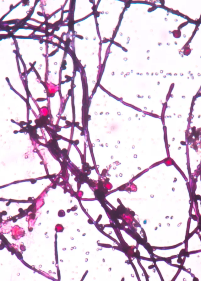  Angiologie – Médecine vasculaire