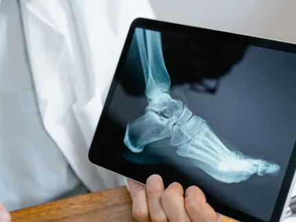 Chirurgie Orthopédique & Traumatologique - Illustration 3