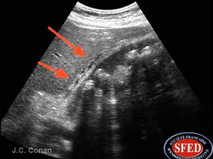 ILLUSTRATION - Gastro