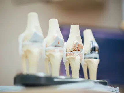 Photo de l'anatomie du genou en plusieurs exemplaires