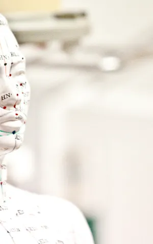 Acupuncture - Illustration