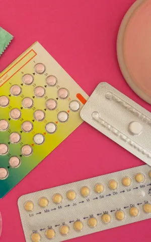 Chirurgie Gynécologique - CONTRACEPTION - ILLUSTRATION