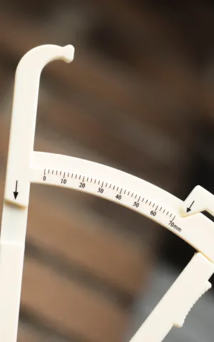 Chirurgie Bariatrique - ILLUSTRATION V3