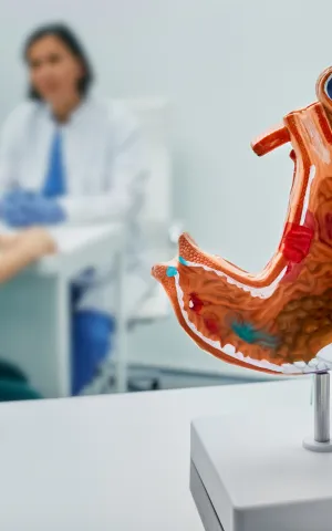 GASTRO ENTERO - ILLUSTRATION