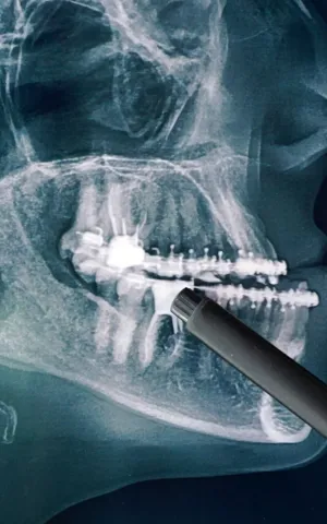 Maxillo faciale - ILLUSTRATION