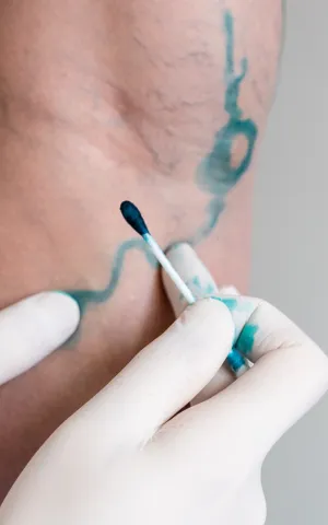 Chirurgie Vasculaire et Thoracique - ILLUSTRATION