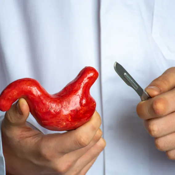 Chirurgie Bariatrique - ILLUSTRATION V1