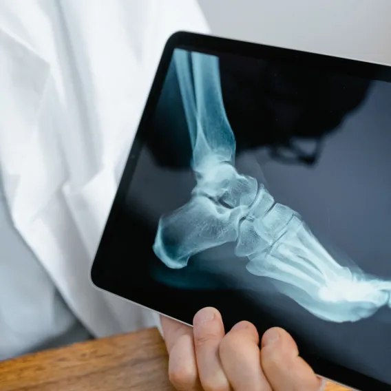 Chirurgie Orthopédique & Traumatologique - Illustration 3