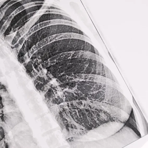 Pneumologie - ILLUSTRATION