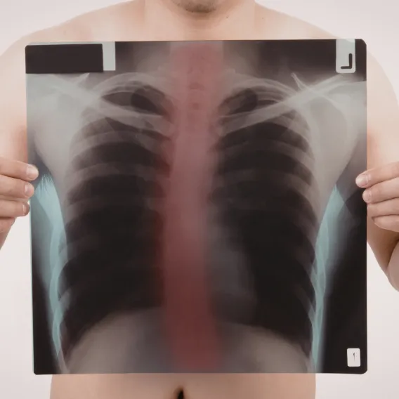 Chirurgie Vasculaire 1